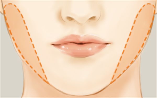 寧波海曙美萊醫(yī)療美容整形醫(yī)院醫(yī)生技術(shù)靠譜嗎？手術(shù)項目有哪些呢？