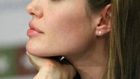 深圳藝星熱瑪吉的效果和醫(yī)生如何？檢索資格和排版!