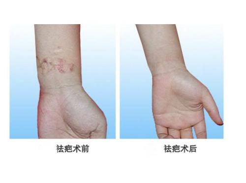 2023濟(jì)南重瞼權(quán)威專家排名榜前十位(周興亮、白華寶、蘇雪蓮技術(shù)強(qiáng)、口碑好)