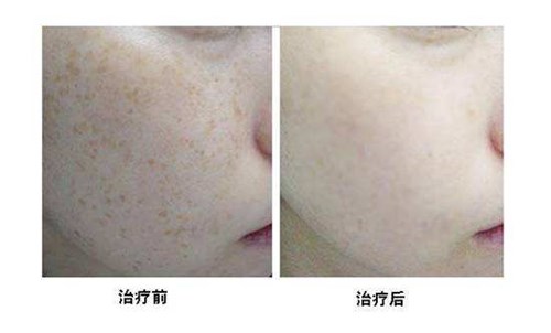 2023十堰微創(chuàng)手術(shù)去生長(zhǎng)紋專家在榜名單前10名(彭斐波、黃金井、林平珍收費(fèi)不貴評(píng)價(jià)好)