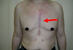 福州果酸換膚哪家醫(yī)院好？