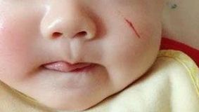 【連云港哪家激光祛斑好，推薦最受用戶歡迎的祛斑機(jī)構(gòu)】