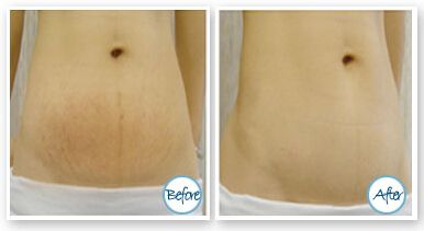 不得不佩服武漢蜜司楊蓉的雙眼皮，簡(jiǎn)直完美！讓我們來了解一下醫(yī)院簡(jiǎn)介、看看一些案例以及價(jià)格的超全信息。