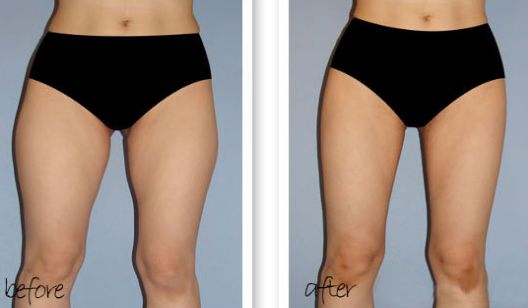 南京哪家醫(yī)院除雀斑好？醫(yī)院雀斑治療排名及效果對比！