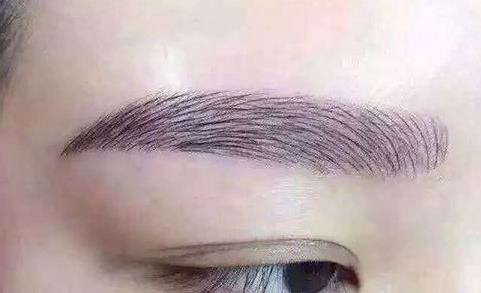 2023年脂肪填充領(lǐng)域的醫(yī)師鄧東偉與趙尤軍，自體脂肪移植技術(shù)的新潮流