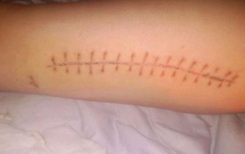 水光針武漢三甲醫(yī)院哪家好？如何選擇適合自己的水光針?lè)?wù)醫(yī)院