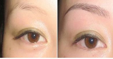 湖北哪家醫(yī)院治療團(tuán)結(jié)口好呢？