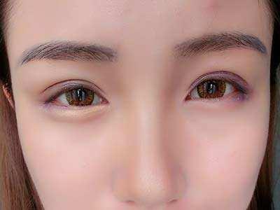 2023合肥魚尾紋專家評(píng)價(jià)TOP10強(qiáng)(羅定安、劉家賀、朱凡口碑價(jià)格出爐)