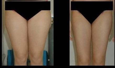 南京做拉皮哪家醫(yī)院好？排名靠前的南京做拉皮醫(yī)院有哪些？