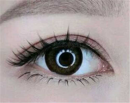 陳育哲假體隆胸效果如何？