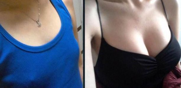 福州鼻梁手術(shù)哪家醫(yī)院好？淺析福州頂級整形醫(yī)院鼻部整形技術(shù)