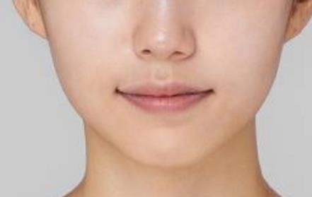 2023濟南膠原蛋白注射墊額頭醫(yī)生排名榜top10強(平金磊、黃志祥、王玉柱干貨帖收藏)