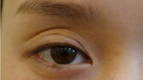 悅美整形醫(yī)院是否是合規(guī)醫(yī)療機(jī)構(gòu)？資質(zhì)概述與名醫(yī)坐診引薦獲取？