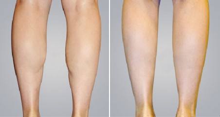 2023太原膨體膨體隆鼻正規(guī)專家推薦前十名(金勇圭、劉金超、楊俊斐勇爭前列！)