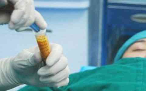 張嬌嬌鼻部整形效果驚艷，愛(ài)思特知名醫(yī)生分享案例美圖，讓我心動(dòng)！