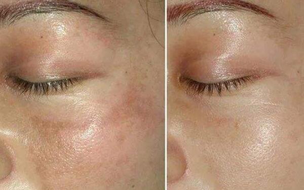 廣州領銜！全新發(fā)布隆鼻專家排行榜！盤點醫(yī)生資料！