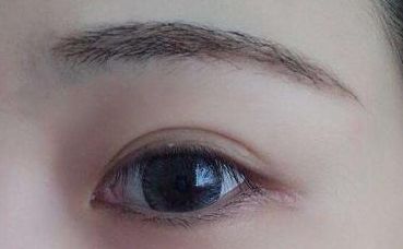 【2023年最新】鄭州哪家雙眼皮醫(yī)院口碑好、技術(shù)高？！