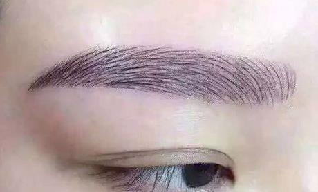 廣州韓后植發(fā)技術(shù)效果如何？劉斌醫(yī)師的植發(fā)手術(shù)靠譜嗎？附植發(fā)價格參考清單