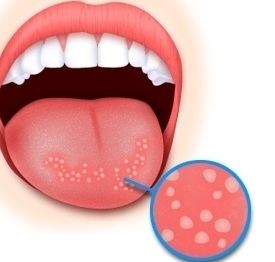 2023蘇州做大腿抽脂排行前十強(qiáng)醫(yī)生(宋艷江、童列健、孫培靈前十詳細(xì)點(diǎn)評)