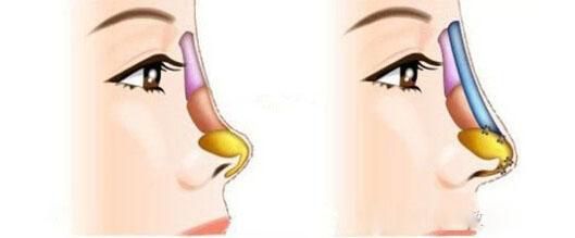 全國哪家醫(yī)院祛斑好？10家值得信賴的專業(yè)醫(yī)院推薦