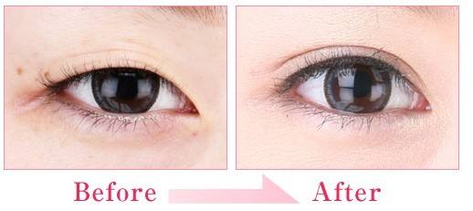 2023杭州小切口祛除眼底紋正規(guī)專家排名榜(馬康、雷小燕、盧建實力介紹全在這)