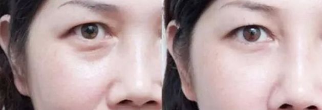 保定市整形外科哪家好？2023年最新榜單及專家推薦！