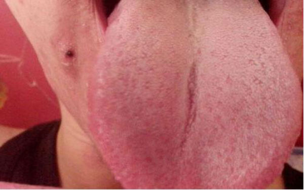 2023湘潭臉部提升除皺術(shù)前10強的專家(彭朝、周剛、李為儒多數(shù)人選擇！)