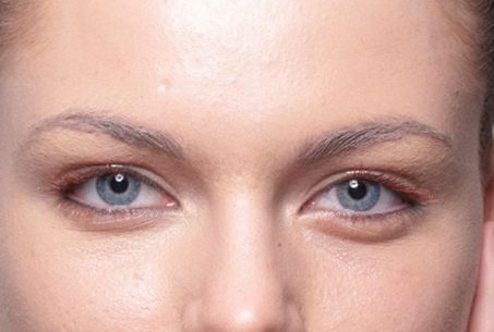 成都有哪些專業(yè)的祛斑祛痘印機(jī)構(gòu)值得推薦？