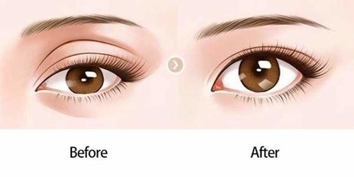 許揚濱隆胸術(shù)的效果評價及相關(guān)費用一覽