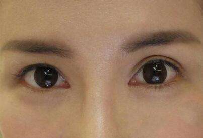 2023杭州自體脂肪豐眉弓正規(guī)專家口碑TOP10強(張常、程磊、黃臺曼口碑擅長、價格簡介盤點)