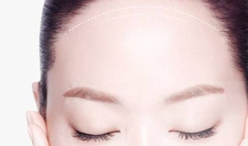 南京做修復(fù)雙眼皮哪家好？解析南京修復(fù)雙眼皮的最佳選擇