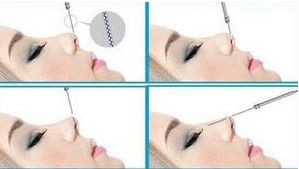 四川哪家醫(yī)院治療狐臭效果好，口碑最佳？