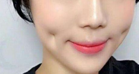 上海超聲刀哪家醫(yī)院做得好？專家推薦，超聲刀手術(shù)最佳選擇