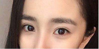 珠海市祛斑好的醫(yī)院哪家靠譜？