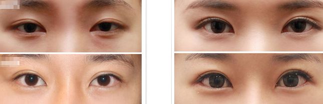 河南哪家醫(yī)院修復疤痕效果好【2023更新】