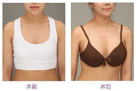 2023鎮(zhèn)江膠原蛋白去除抬頭紋top10的醫(yī)生(尹康、何雪蓮、徐斌這家醫(yī)美機(jī)構(gòu)獲得本地朋友安利)