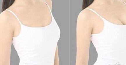 中國醫(yī)科大學(xué)附屬醫(yī)院美容科卓越醫(yī)生名單，親測案例圖詳解！