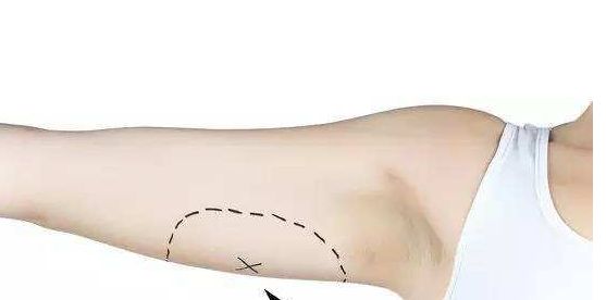 南京去除黃褐斑醫(yī)院排名及口碑，哪家值得信賴？