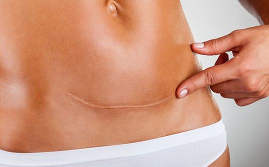 【北京唇裂修復(fù)哪家醫(yī)院好？專家推薦權(quán)威醫(yī)療機(jī)構(gòu)】