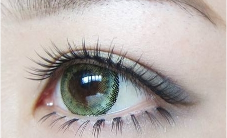 重慶現(xiàn)代整形美容醫(yī)院吳玉娟激光祛斑效果評估