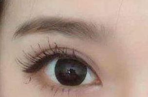 蘇州哪家醫(yī)院的熱瑪吉療效好？