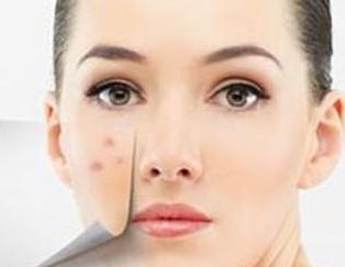 廈門哪家醫(yī)院墊鼻子好？專家推薦的Top5廈門墊鼻子好醫(yī)院