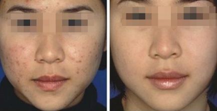 連云港眼部激光飛秒那家好？排名領(lǐng)先的專業(yè)眼科醫(yī)院推薦