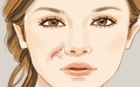 天津有哪些醫(yī)院的祛痘效果好？哪家醫(yī)院的祛痘效果最佳？