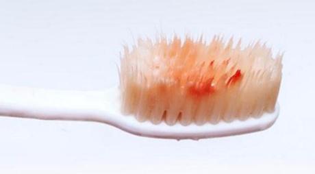 2023武漢朝天鼻矯正口碑十強(qiáng)醫(yī)生(馬佛根、宋林章、張巍口碑（技術(shù)）不可小覷)