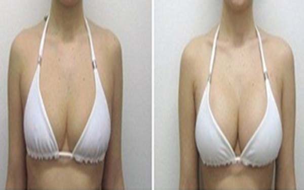 2023西安電波拉皮去蝴蝶斑專家排行榜前十(王瑞、盧丙侖、王曉鵬上榜的都是高人氣醫(yī)生列表！)