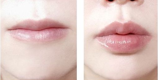 山東隱耳整形哪家醫(yī)院好？專業(yè)評測及患者真實(shí)分享