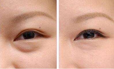 洛陽(yáng)有減肥醫(yī)院哪家好？瘦身專家推薦幫您選擇洛陽(yáng)最好的減肥醫(yī)院