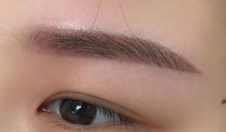 浙一醫(yī)院徐靖宏抽脂效果滿意嗎？有全新價(jià)格表嗎？