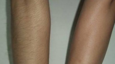 商丘杜韓整形醫(yī)院和華美之間如何選擇？雙眼皮手術(shù)價(jià)格一覽表